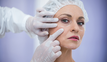 Eyelid Surgery (Blepharoplasty)
