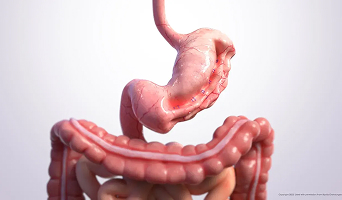 Endoscopic Sleeve Gastroplasty (ESG)