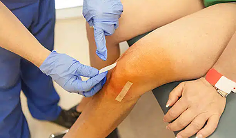 Knee Replacement Surgery